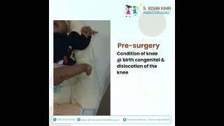Case Study - Congenital Dislocation Of The Knee